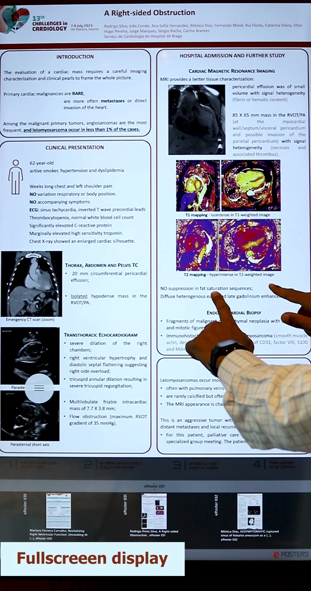 An ePoster displayed full screen
